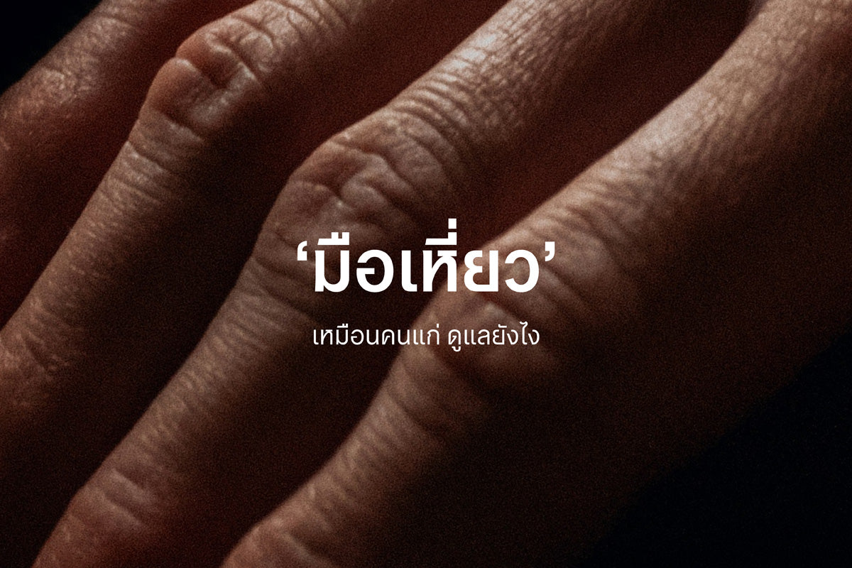 มือเหี่ยวเหมือนคนแก่ ดูแลยังไง